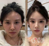 武汉微整注射医生哪个好