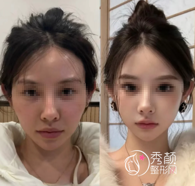 武汉微整注射医生哪个好？朱胜军、王政祥、贺建平、郭凌宇…实力强