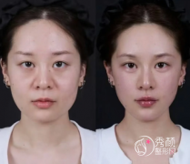 杭州微整注射医院哪家好