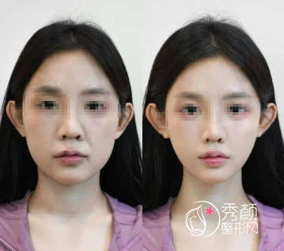 天津微整注射医生哪个好？张文俊、宋建星、李宇飞…幼态脸打造很出众