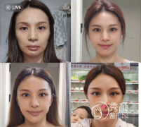 北京拉皮好的医生有哪些