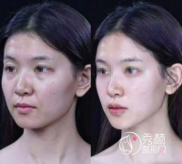 石家庄微整注射医生哪个好？姜国娟、冯亚兵、翟彦刚、王宝林…实力出众