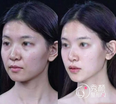 石家庄微整注射医生哪个好？姜国娟、冯亚兵、翟彦刚、王宝林…实力出众