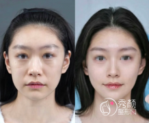 西安微整注射医院哪家好