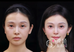 厦门微整注射医院哪家好？厦门大学附一院、厦大附属中山医院、华美…