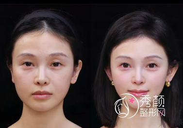 厦门微整注射医院哪家好？厦门大学附一院、厦大附属中山医院、华美…