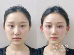 上海幼态脸哪个医生好？