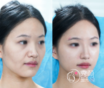 重庆微整注射医生哪个好？曹美、刘林奇、杨任欢…优势突出