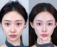 成都幼态脸哪个医生好？