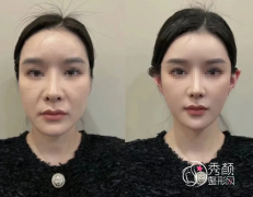 广州轮廓固定打的比较好