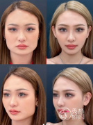 广州磨骨出名的专家有哪