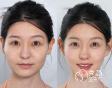 苏州轮廓固定医院哪家好？市立医院、康美、美贝尔、施美尔…各有优势