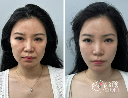 福州轮廓固定医院排名，热门整形机构名单vs口碑专家一览