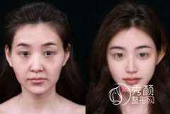 南昌微整注射医生哪个好