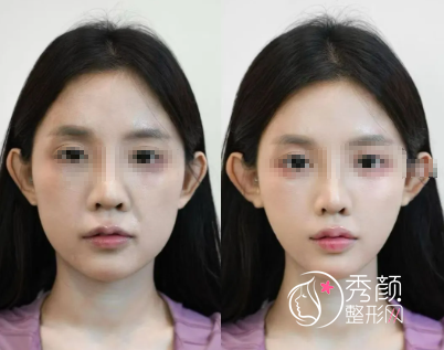 青岛微整注射医生哪个好？高玉洁、史瑞晶、朱利娜、林红…审美出众