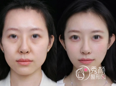 厦门轮廓固定医院哪家好？搜集人气旺、口碑好的热门整形机构