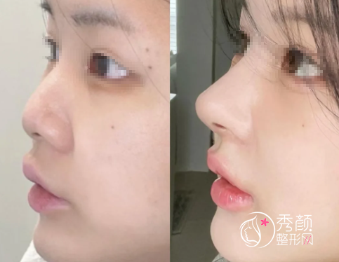 北京鼻修复好的专家有哪些？龙飞、蒋亚楠、宫风勇、汪垟…优势满满