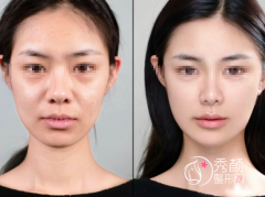 济南微整注射医生哪个好