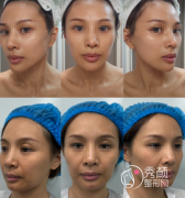 武汉哪里做拉皮手术好？江城、美基元、中翰、五洲…强势上榜