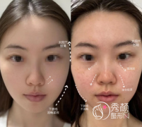 东莞轮廓固定医院排名：缔美、韩美、壹加壹、西妃…资质齐全，正规靠谱