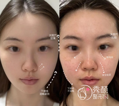 东莞轮廓固定医院排名：缔美、韩美、壹加壹、西妃…资质齐全，正规靠谱