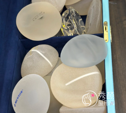 魔滴Motiva和曼托有什么区别？高端隆胸假体motiva魔滴Motiva价格5w起