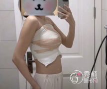 上海隆胸医生排名：江华