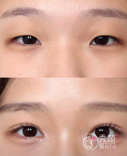 武汉眼部整形出名的医生有哪些？吴小蔚、李哲、蒋思军、江岳…