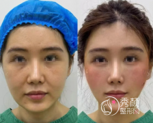 徐州做轮廓固定医院哪家好？盘点当地热门、审美素养高的整形医院