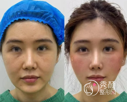 徐州做轮廓固定医院哪家好？盘点当地热门、审美素养高的整形医院