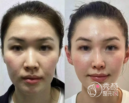 宁波幼态脸打造哪位医生好?龚全康、张宝琳、马文章、王春娟…优势展示