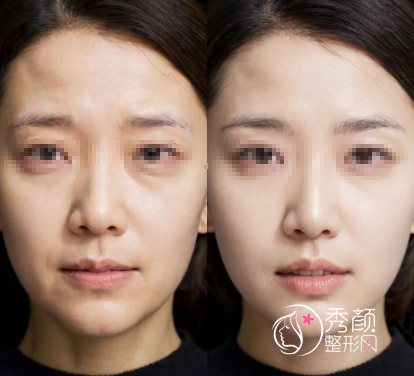 郑州再生材料注射医生哪位好？郭文婧、杨柳、张歌等实力优选！