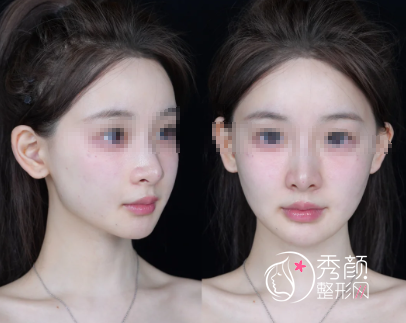 福州再生材料注射医生哪位好？曹泓、叶颖、许丽琳、刘大庆…综合实力很强