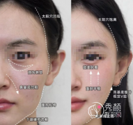 宁波再生材料注射哪家好？市一医院、宁大医学院附属医院、静港、艺星时代