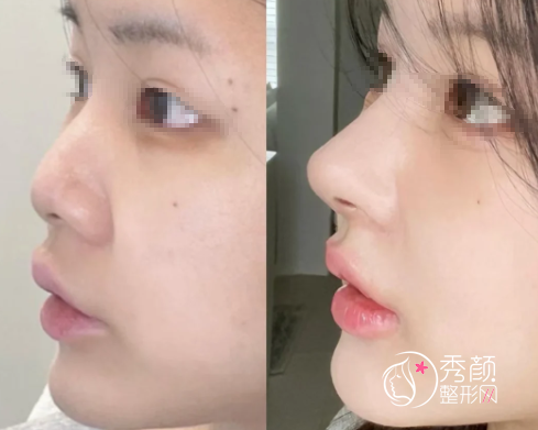 武汉做鼻子有名气的医生排名：黄立、吴小蔚、魏红军、郭能强、田治国…各有优势