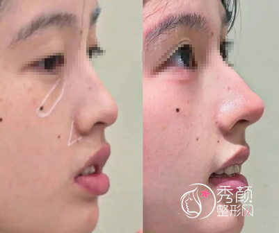 武汉做鼻子有名的整形医生有哪些？郭亮、朱胜军、田治国、钟爱梅…实力出众