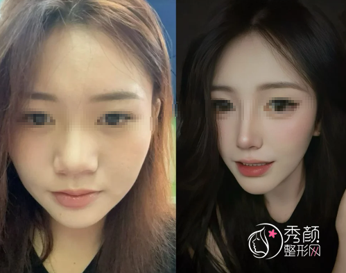 成都出名的隆鼻医生有哪些？于晓波、黄开亮、郑红革、卿勇…技术优势出众