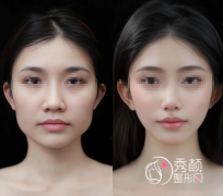 大连下颌角整形医院排行