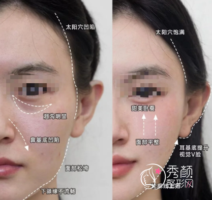 轮廓固定幼态脸全靠这个方法论筛选出来靠谱注射医生！