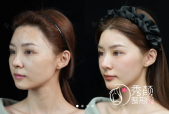 郑州轮廓固定医院排行榜