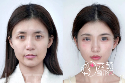 长沙轮廓固定找哪个医生做好？雷少榕、刘质彬、陈仕文、刘春明…人气很旺