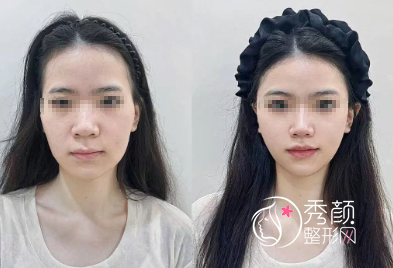 西安注射微调大佬名单：徐智慧、杨春梅、刘青、杨玉巧口碑审美好！