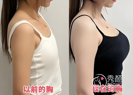 南京隆胸好的医美医院排名，内含实力整形医院名单&人气专家优势点评