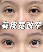 广州眼修复医生哪个好？