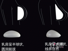 杭州隆胸比较好的医生排名：栗勇、易成刚、万连壮、徐靖宏…实力出众