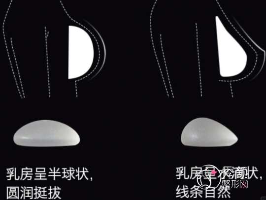 杭州隆胸比较好的医生排名：栗勇、易成刚、万连壮、徐靖宏…实力出众