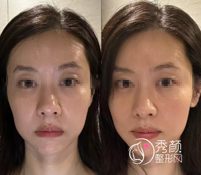 北京面部提升哪家医院好？北医三院、八大处、美莱、华韩…在业界热度高