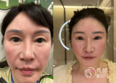 天津拉皮好的医生有哪些？顾俊平、刘曼、曹丽红、张宝良…实力强