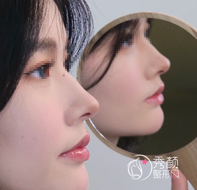 深圳做鼻子好的医生排名榜：李俊、王勇、李天石、梁志为…优势满满