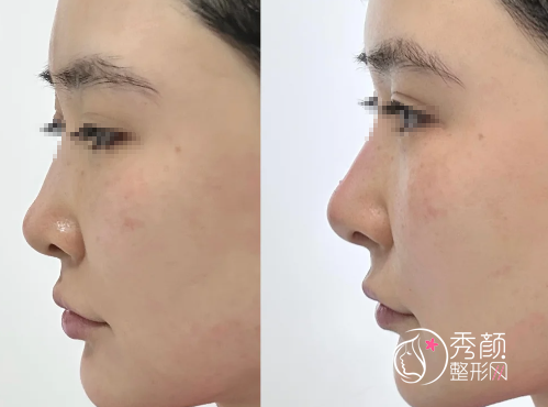 郑州做鼻子比较好的医院有哪些？市一人民医院、省人民医院、缔莱美…实力出众